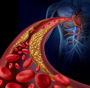 Beyond Cholesterol Testing: Cardiovascular Health