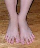 Natural Foot Pain Relief