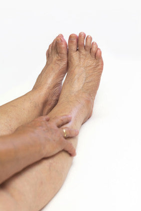 Natural Remedies For Varicose Veins